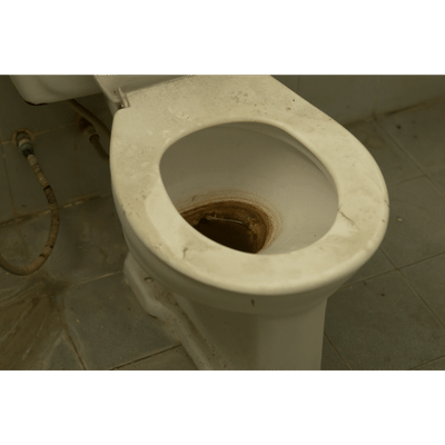 How to Remove Limescale From Toilet Bowls