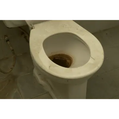 How to Remove Limescale From Toilet Bowls